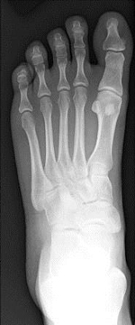 علت درد کف پا در طب سنتی