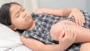 پادرد در کودکان